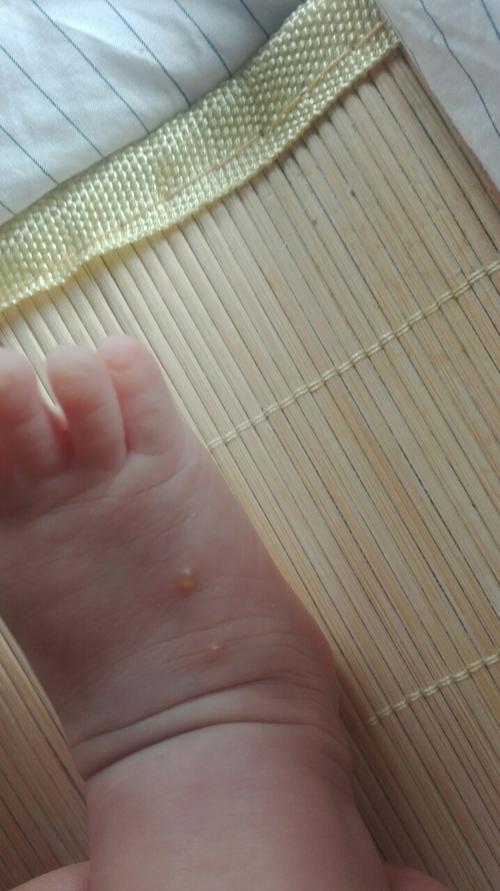 宝宝脚上长的是什么,只有两个