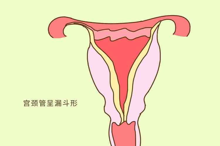 宫颈的正常长度在3~4.0cm左右,若是女性的宫颈长度小于2.