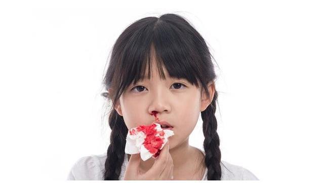 孩子经常流鼻血是因为干燥还是患上白血病这才是真相